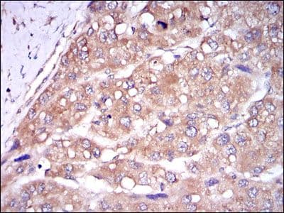 CASP8 / Caspase 8 Antibody (clone 1H11)