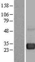 RAB7A / RAB7 Protein (Over-Expression Lysate Myc-DDK (Flag))