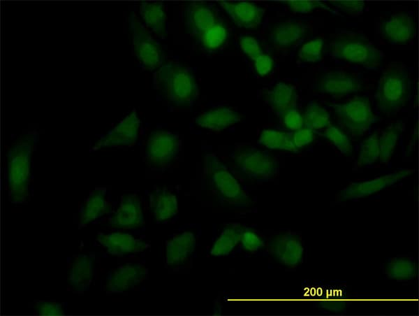 KIF2C / MCAK Antibody (clone 1G2)