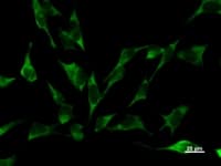 YARS / Tyrosyl-tRNA Synthetase Antibody (clone YAR5H08)