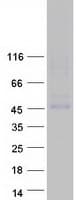Human TMEM184C Protein (Recombinant Myc-DDK (Flag))