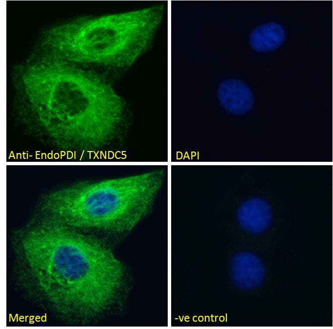 IHC-plus™ TXNDC5 / ERP46 Antibody (aa419-432)