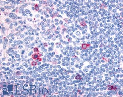 IHC-plus™ CNR2 / CB2 Antibody (Cytoplasmic Domain)