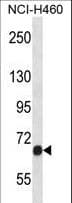 FGFR1 / FGF Receptor 1 Antibody (aa756-784)