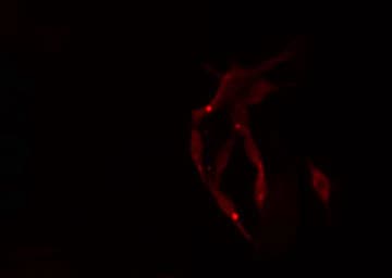 CCS Antibody