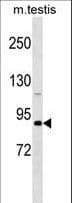 DDX4 / VASA Antibody (aa103-131)