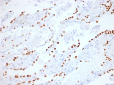 Recombinant Monoclonal Rabbit anti-Human NKX2-1 / Thyroid-Specific TF Antibody (clone NX2.1/1855R, IHC)