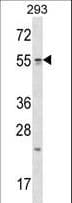 Polyclonal Rabbit anti-Human TTC23 Antibody (aa137-165, WB)