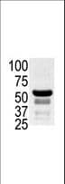 PAK2 Antibody (aa192-222)