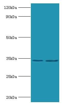 Rabies Virus Phosphoprotein Antibody