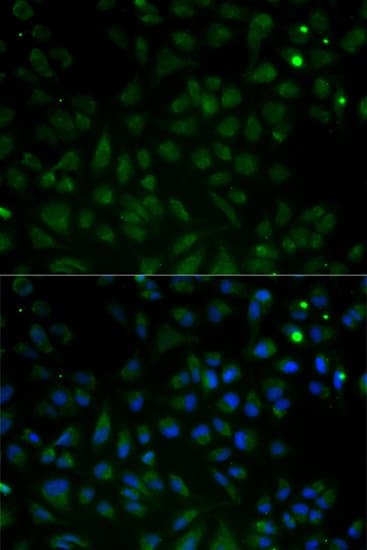 VDAC1 / PORIN Antibody (aa1-283)