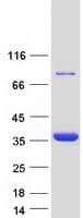 Human TPM3 Protein (Recombinant Myc-DDK (Flag))