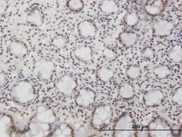 Monoclonal Mouse anti-Human NFKB1 / NF-Kappa-B Antibody (clone 4A11, IHC, IF, WB)