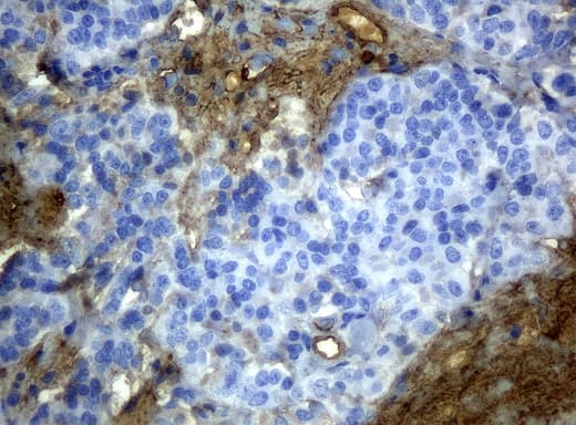 HP / Haptoglobin Antibody (clone UMAB10)