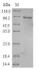 Human CSNK1A1L Protein (Recombinant GST, N-terminus)