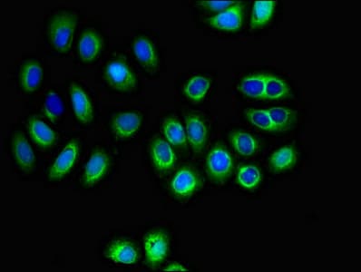 Polyclonal Rabbit anti-Human SLC16A8 Antibody (IHC, IF, WB)