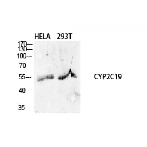 CYP2C19 Antibody (210-290 aa, Internal)