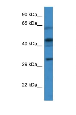 CRLF1 Antibody (aa149-198)