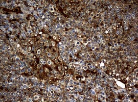 TP / Thymidine Phosphorylase Antibody (clone OTI5B5)