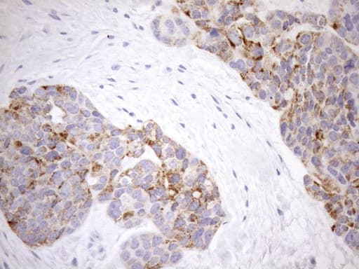 PPIF / Cyclophilin F Antibody (clone OTI1G8)