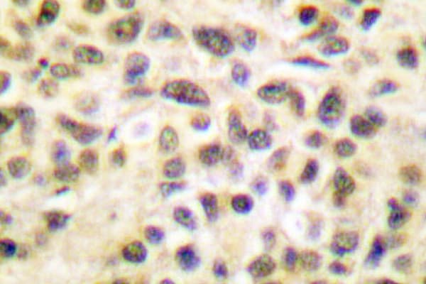 Polyclonal Rabbit anti-Human TFDP1 Antibody (Val393, IHC, IF, WB)
