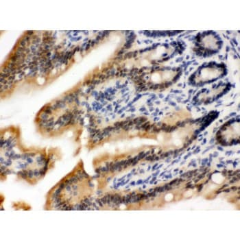 OGT / O-GLCNAC Antibody (aa1008-1046)