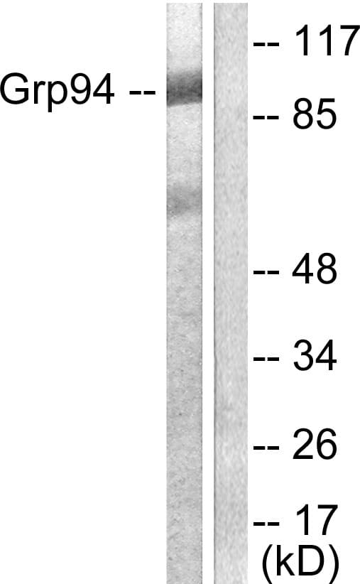 IHC-plus™ HSP90B1 / GP96 / GRP94 Antibody (aa754-803)