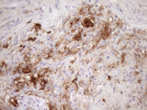 Monoclonal Mouse anti-Human CPM / Carboxypeptidase M Antibody (clone OTI1F8, aa124-423, IHC, WB)