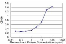 HMGCS2 / HMG-CoA Synthase 2 Antibody (clone 1E9)