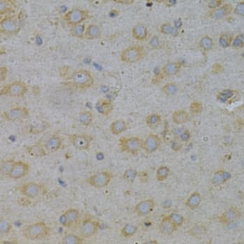 GGA2 Antibody
