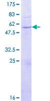 Human GZMH / Granzyme H Protein (Recombinant GST)