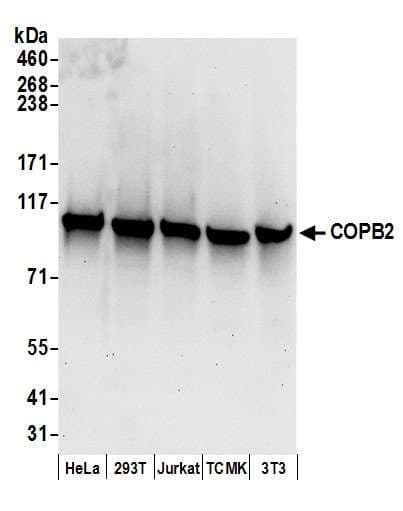 Polyclonal Rabbit anti-Human COPB2 / Beta-COP Antibody (aa856-906, IHC, WB)