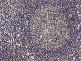 MAP2K3 / MEK3 / MKK3 Antibody (clone OTI5D3, Carrier-free)