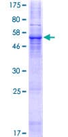 Human TVP23C Protein (Recombinant GST)