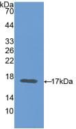 CEA / Carcinoembryonic Antigen Antibody (aa85-222)