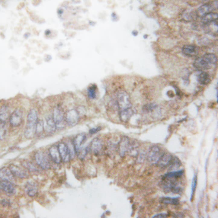 c-CBL Antibody (phospho-Tyr674)