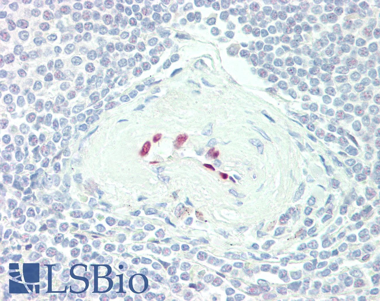 IHC-plus™ Polyclonal Rabbit anti-Human IL-33 Antibody (IHC, WB)
