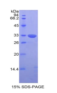 Human KIR2DS4 Protein (Recombinant His)