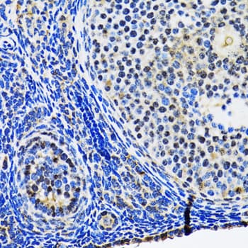 TP53 / p53 Antibody