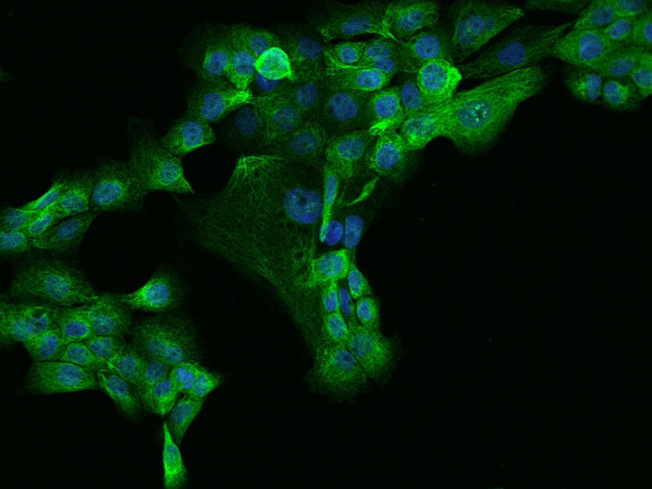 MAP7 Antibody