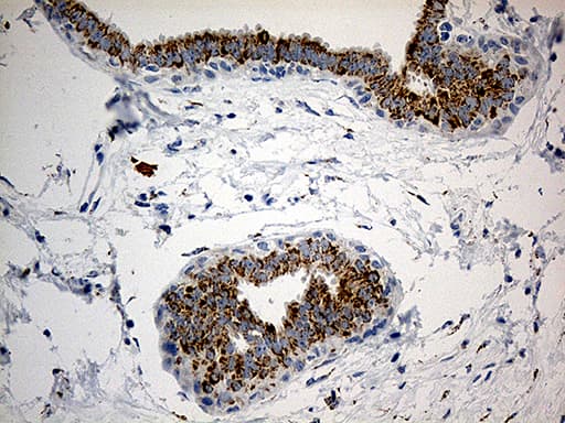 Monoclonal Mouse anti-Human PYCR1 Antibody (clone OTI4F2, aa1-319, IHC, WB)