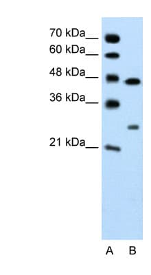 CLDN18 / Claudin 18 Antibody (C-Terminus, HRP)