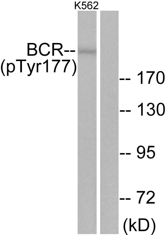 CML / BCR Antibody (phospho-Tyr177)