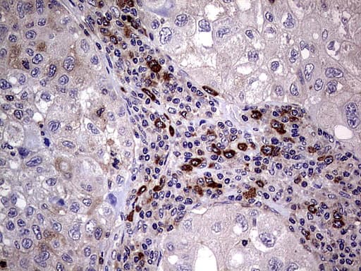 R1 / RRM1 Antibody (aa541-792, clone UMAB165, Carrier-free)