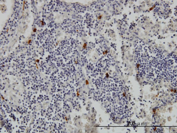 Monoclonal Mouse anti-Human TPSAB1 / Mast Cell Tryptase Antibody (clone 2A10-B5, IHC, WB)