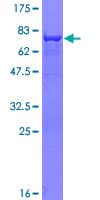 Human ELAC1 Protein (Recombinant GST)