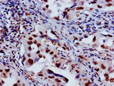 Polyclonal Rabbit anti-Human HIST1H3A Antibody (IHC, IF, WB)