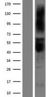 ART3 Protein (Over-Expression Lysate Myc-DDK (Flag))