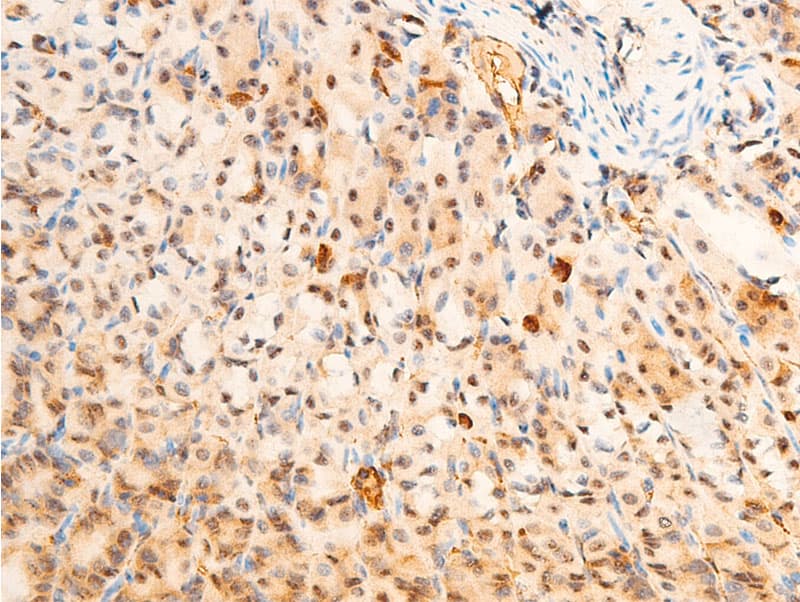 PDPK1 / PDK1 Antibody (phospho-Ser241)