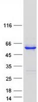 Human C17orf75 Protein (Recombinant Myc-DDK (Flag))